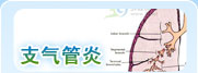 支气管炎